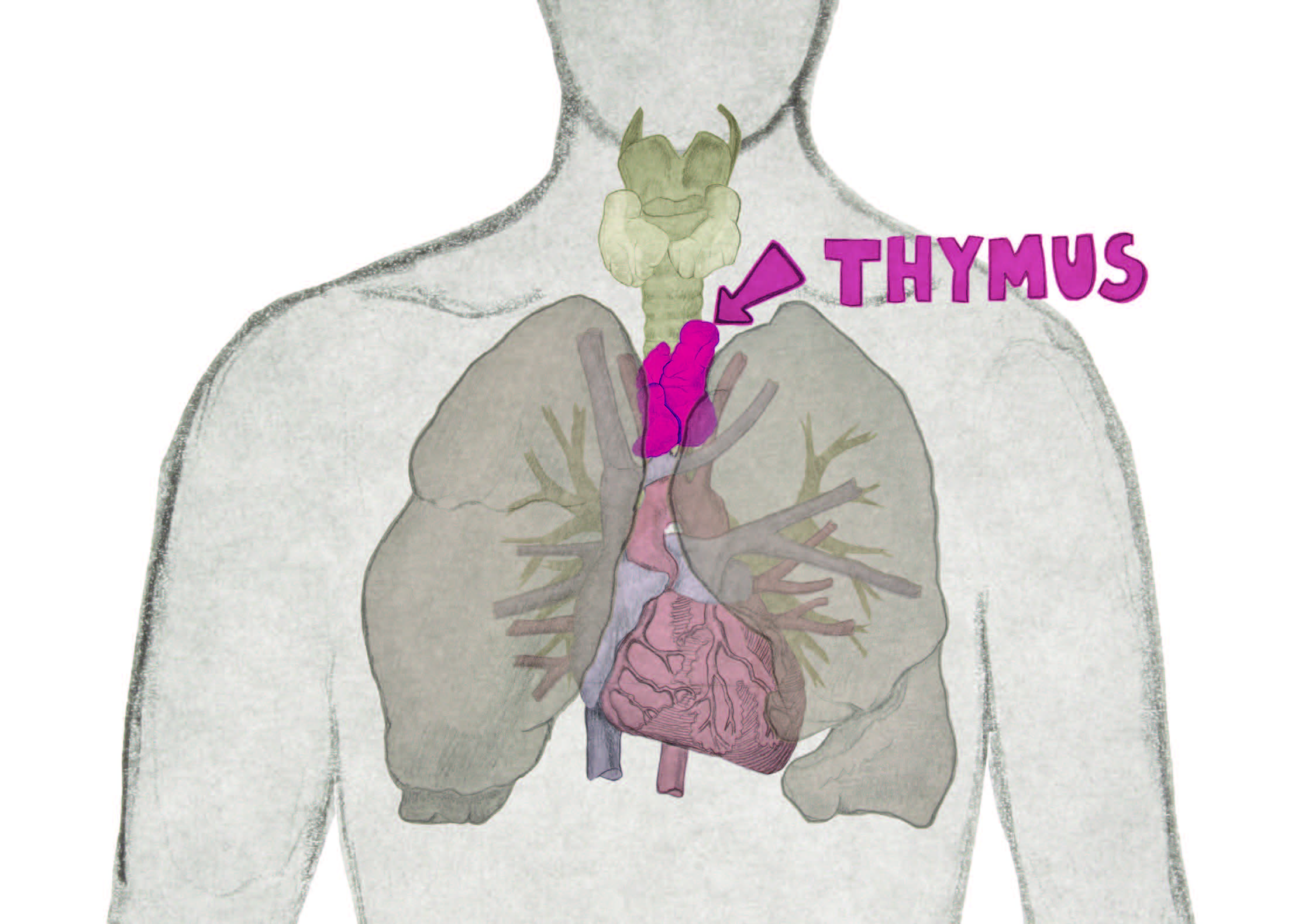 Cancer du thymus définition, cause, symptômes, traitement